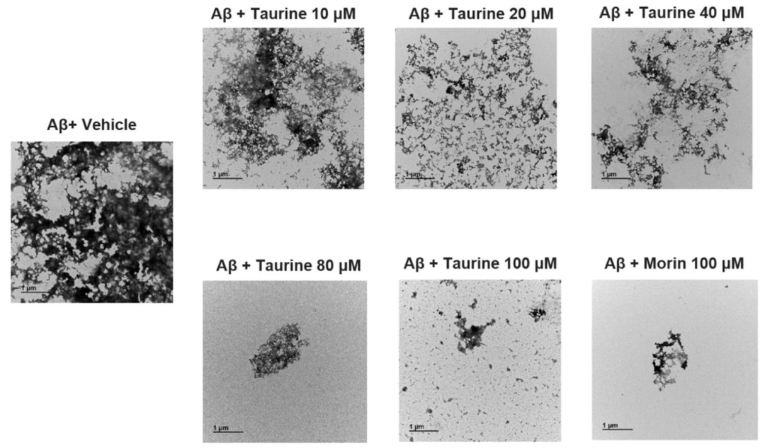 图 2：牛磺酸改变 Aβ₄₂纤维形态(TEM 分析)