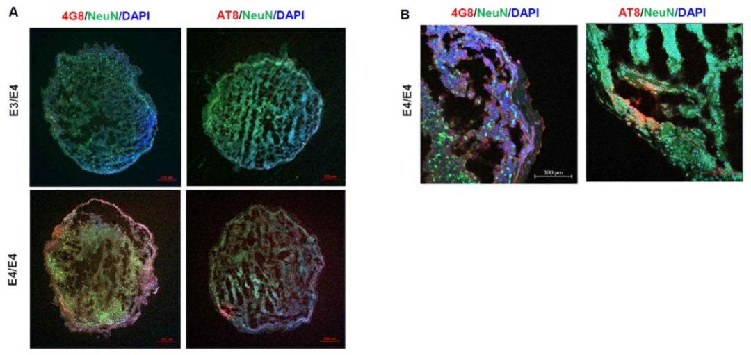 图 7：APOE ε4/ε4 类器官复现 AD 病理