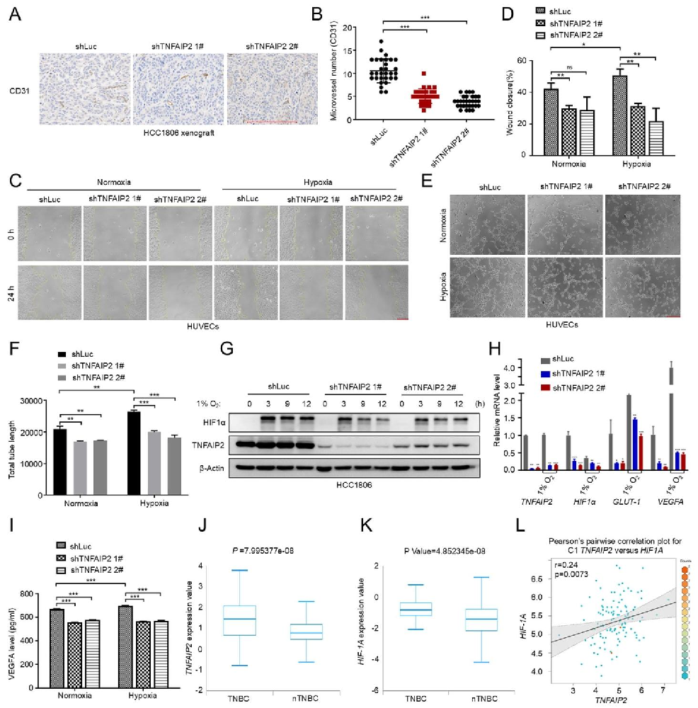 图1：TNFAIP2 促进 TNBC 血管生成及 HIF1α 表达