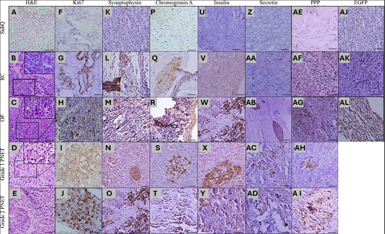 图3:小鼠胰腺神经内分泌肿瘤异种移植模型的组织学和免疫组化分析