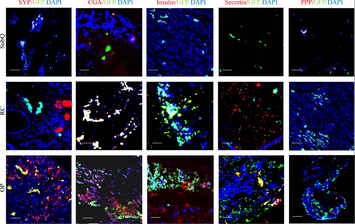 图5:小鼠胰腺神经内分泌肿瘤模型中神经内分泌标志物的共免疫荧光分析