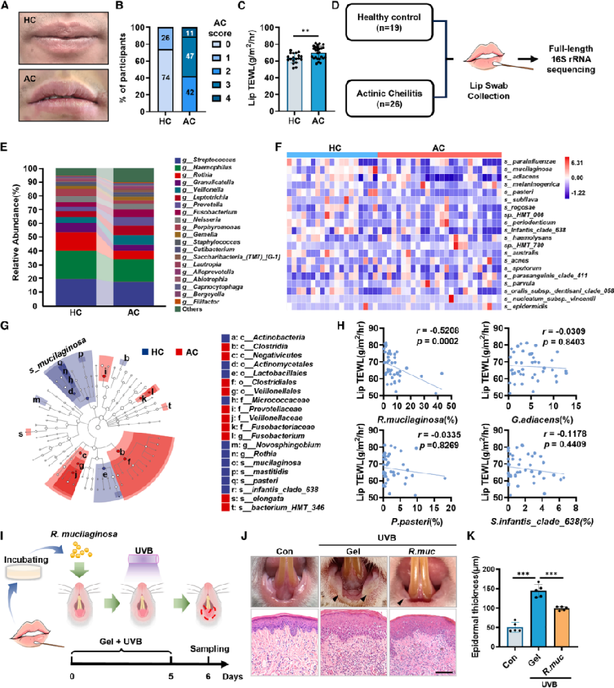 图1 | 人唇红部粘液罗斯菌丰度及其对UVB损伤的保护作用