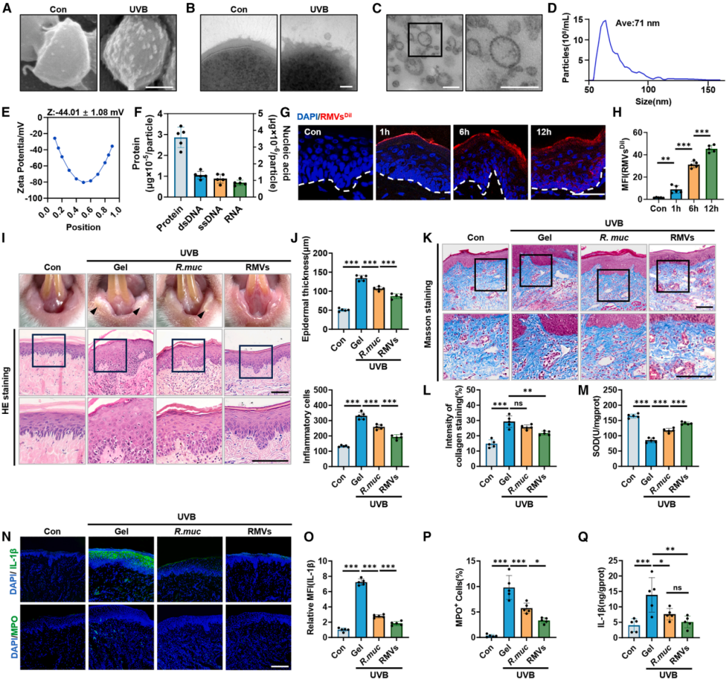 图2 | 粘液罗斯菌释放的RMVs减轻UVB诱导的黏膜损伤