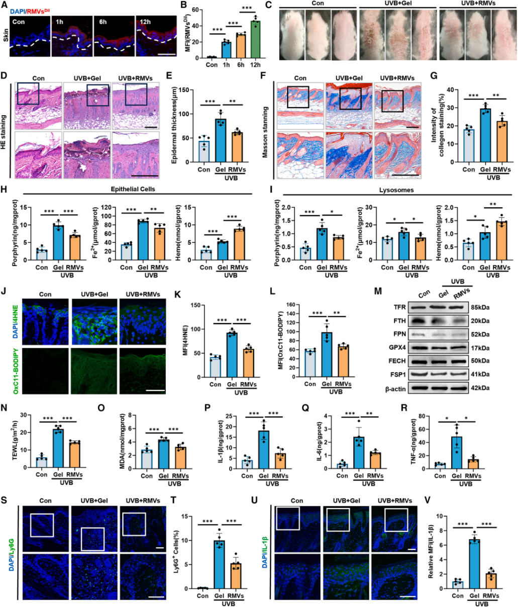 图6 | RMVs催化Fe²⁺和卟啉生成血红素以抑制铁死亡并减轻UVB诱导的皮肤损伤