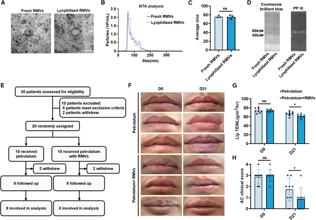 图7 | RMVs在临床前模型和临床试验中缓解慢性UV损伤