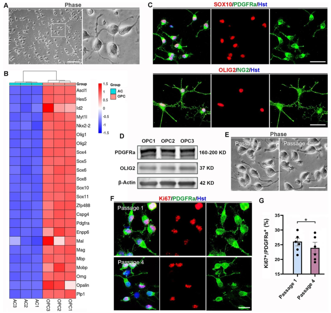 图6:OPCs 的生物学特征鉴定