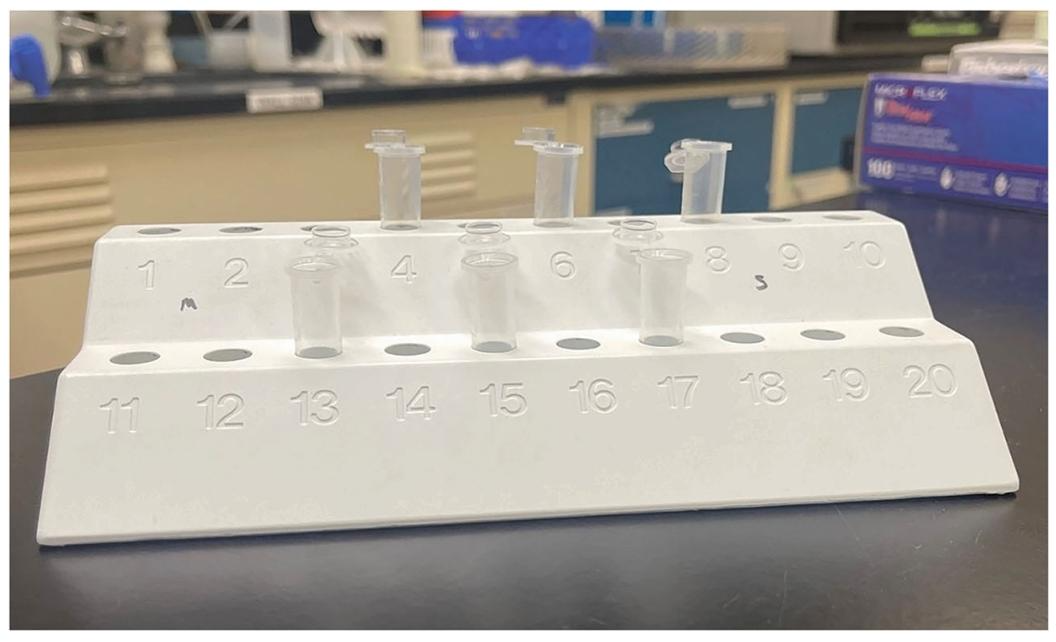 图7-8：移植前 SCs 浓缩