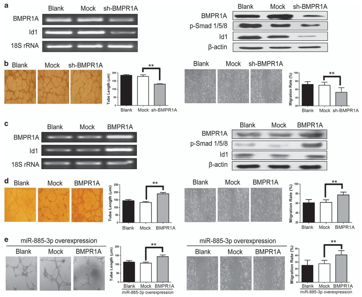 图4:BMPR1A 促进 HMEC-1 细胞的血管生成和 BMP/Smad/Id1 信号通路激活