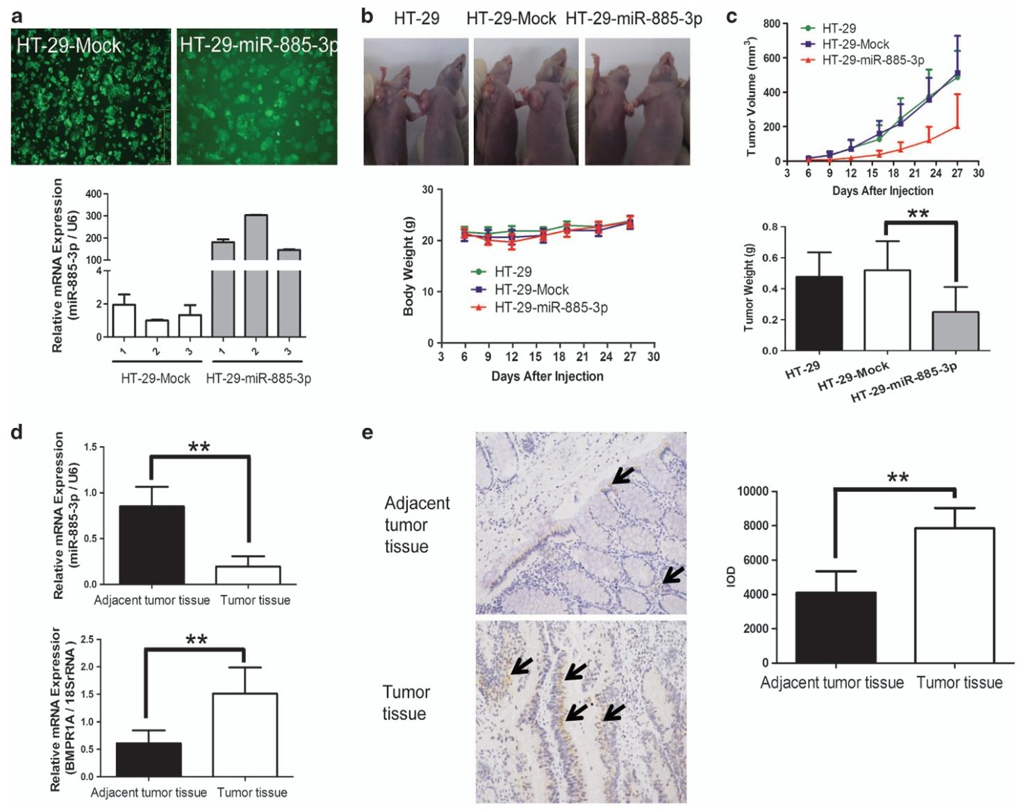 图6:miR-885-3p 抑制裸鼠中 HT-29 结肠癌异种移植物生长,且结肠癌临床标本中 miR-885-3p 低表达、BMPR1A 高表达