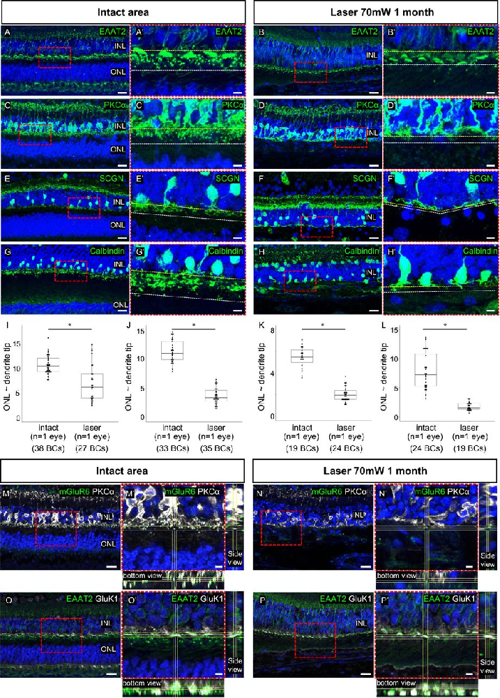 图 1：激光处理后 BCs 树突退缩