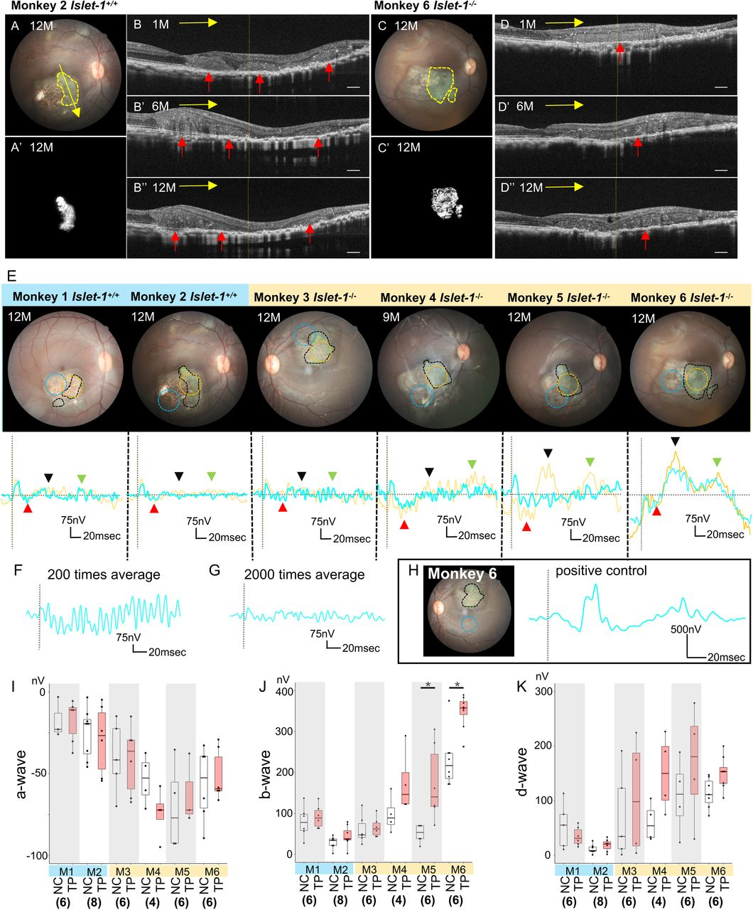 图 2：FMERG 证实 Islet-1⁻/⁻ ROs 恢复功能