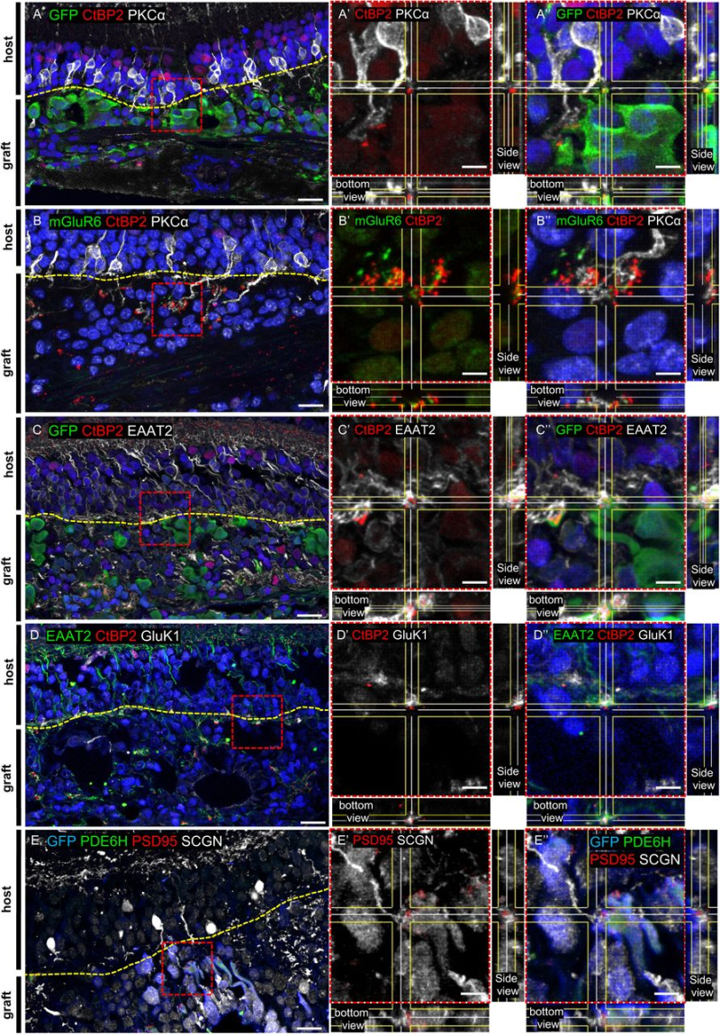 图 6：免疫组化证实突触标记共定位
