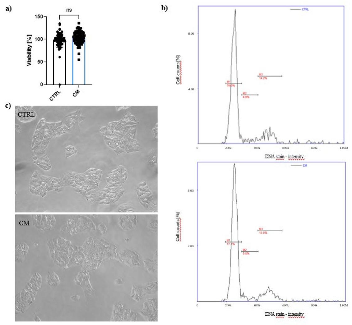 图3：CM 对 HepG2 细胞活力、细胞周期及形态的影响