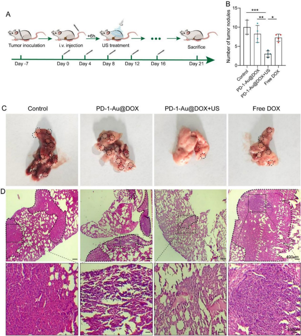 图 7 | 体内肺转移抑制效果评估。