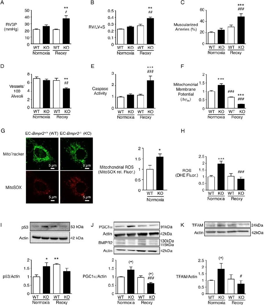 图1：EC-Bmpr2⁻/⁻小鼠在缺氧 - 复氧后表现为持续性肺动脉高压及线粒体功能异常