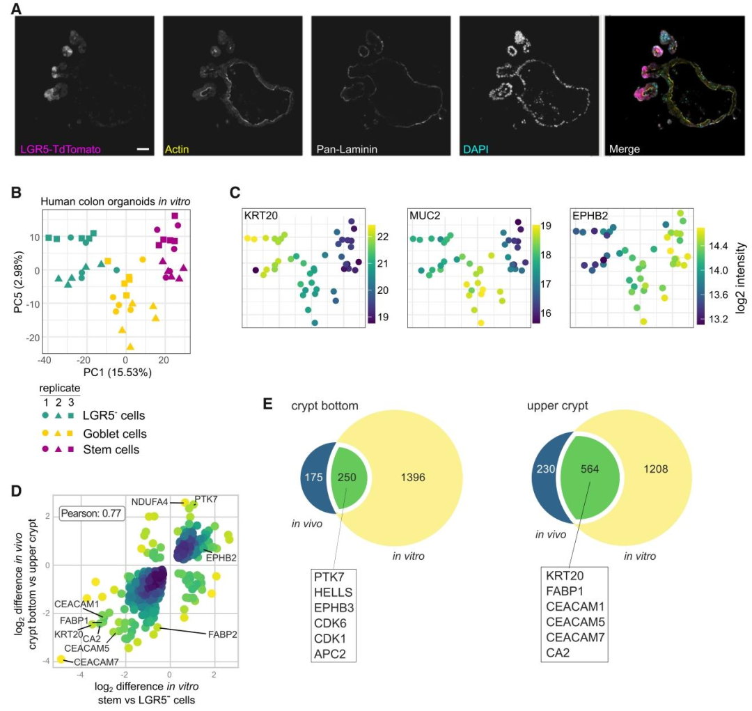 图 2：体外类器官与体内 IECs 的蛋白质组相关性