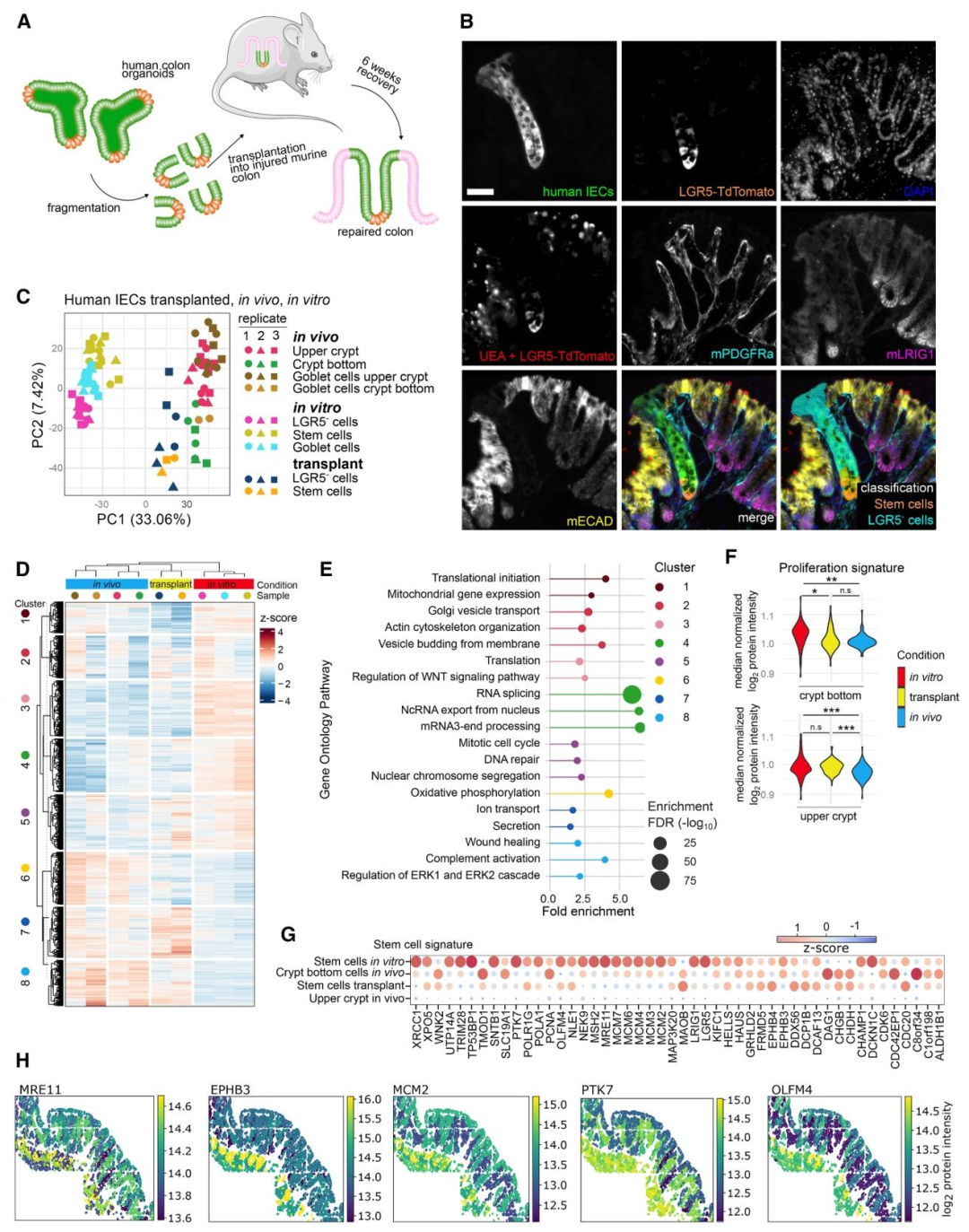 图 3：原位移植类器官的表型分析