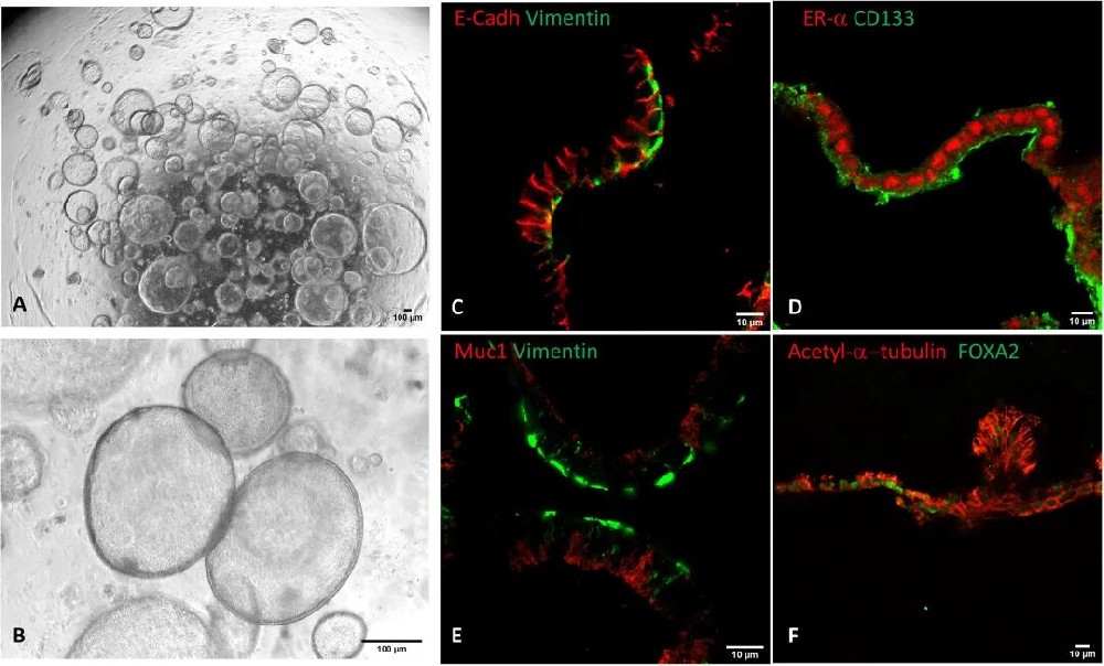 图 1：传统子宫内膜类器官的生成与上皮特征验证