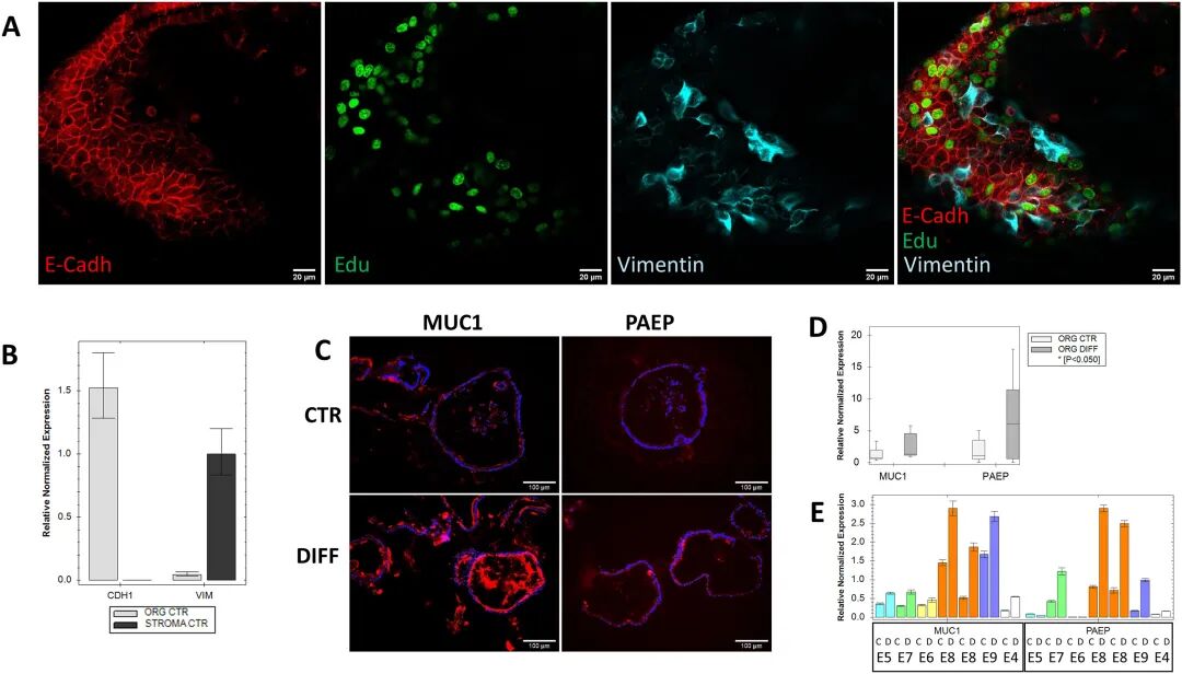 图 1：传统子宫内膜类器官的生成与上皮特征验证