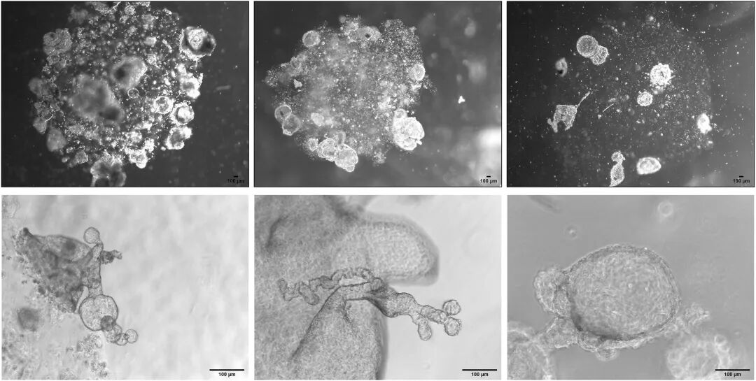 图 1：传统子宫内膜类器官的生成与上皮特征验证