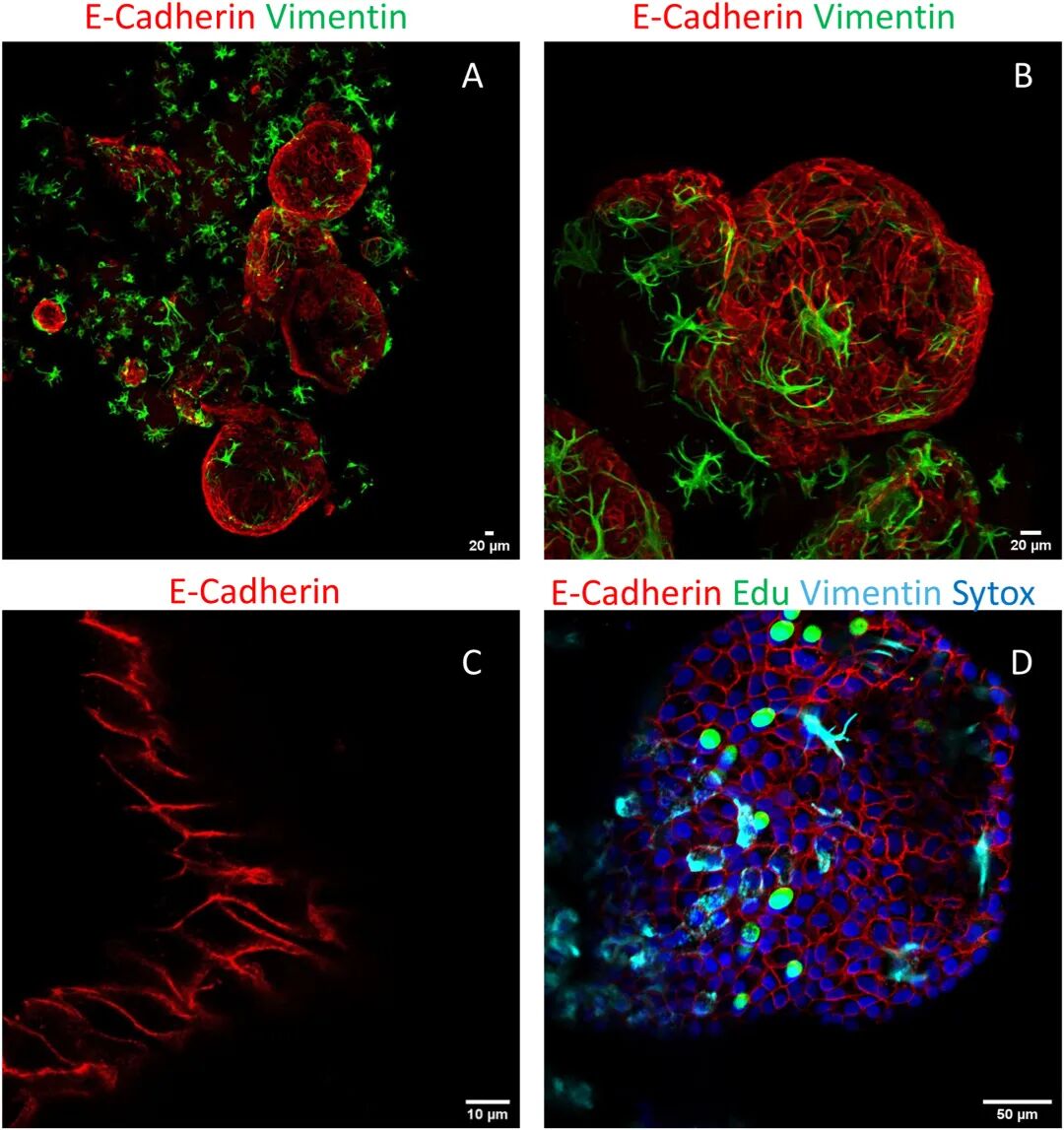 图 4：漂浮类器官的上皮 - 基质细胞共存验证
