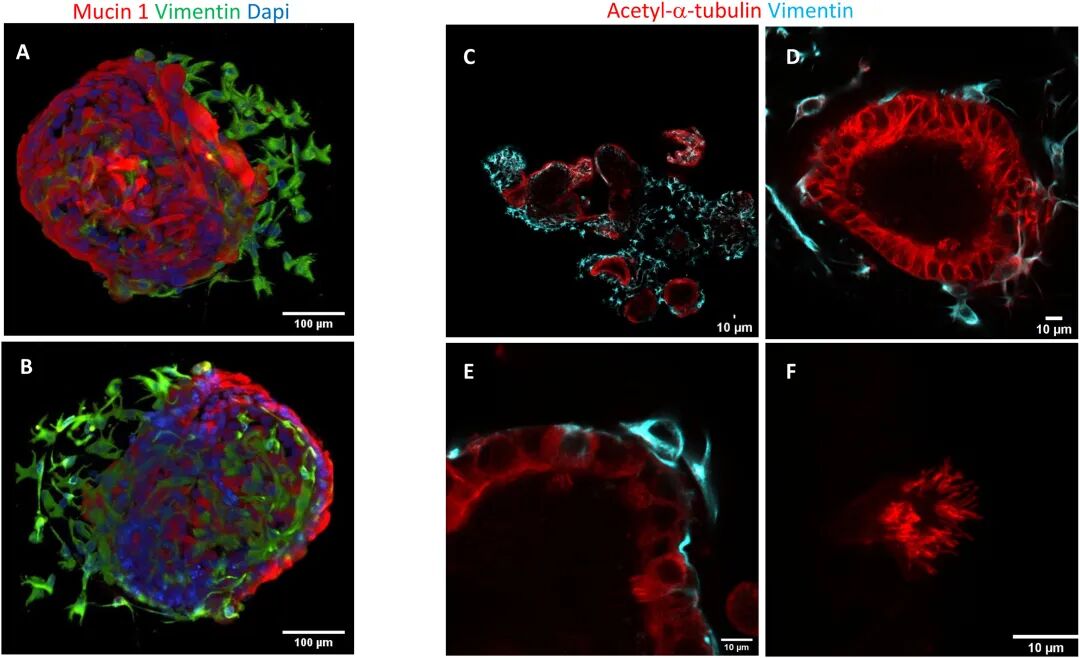 图 5：漂浮类器官的腺体功能标志物表达