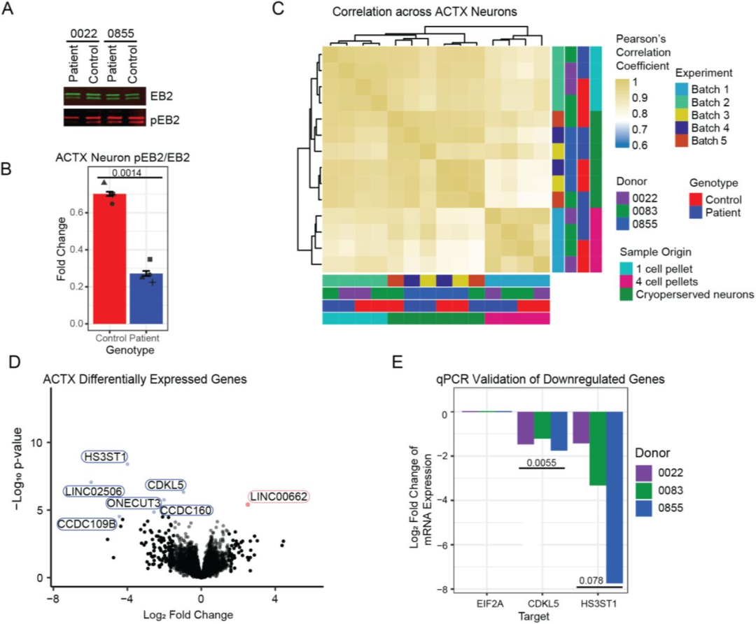 图 3：ACTX 神经元的 CDKL5 缺陷与基因表达变化