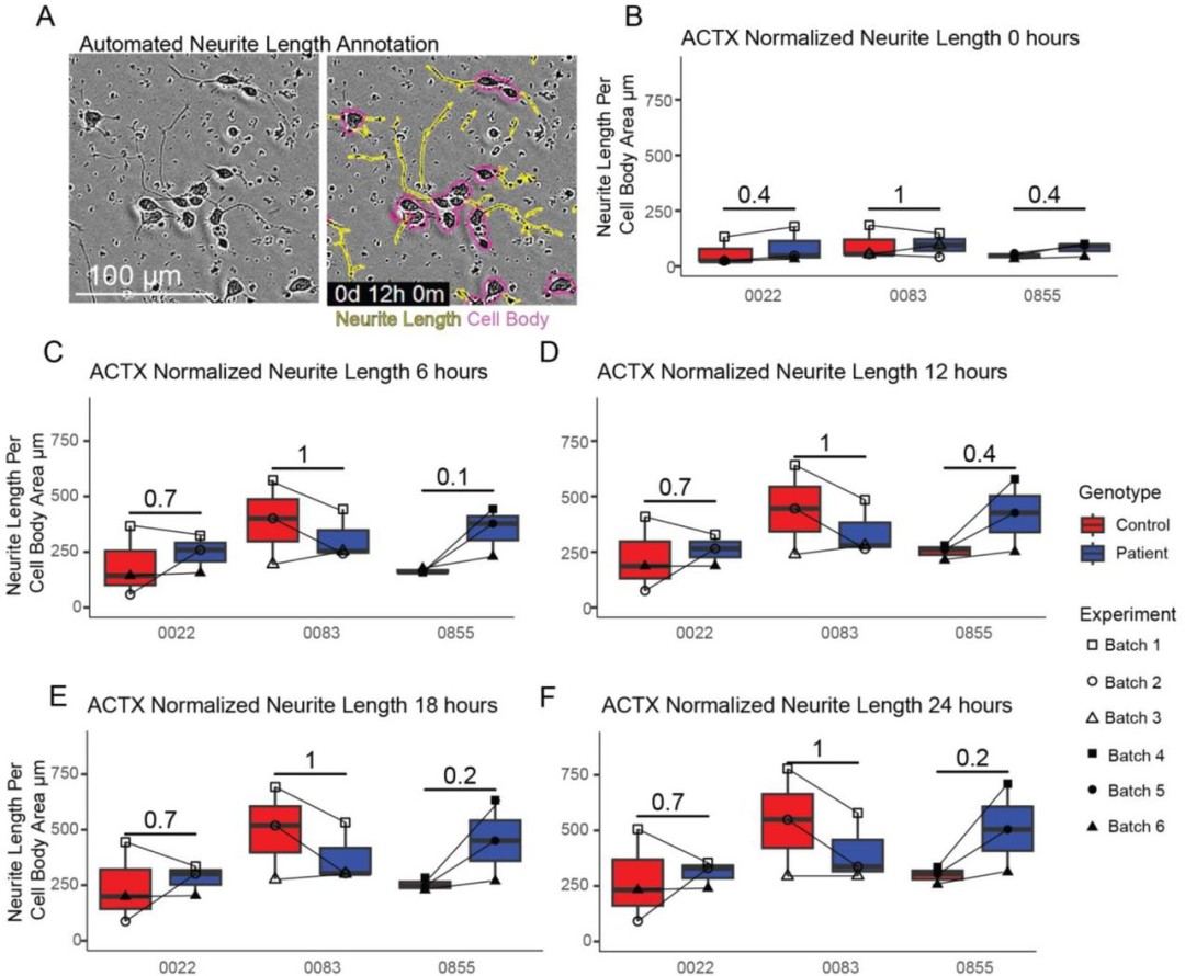 图 4：ACTX 神经元的 neurite 长度无差异