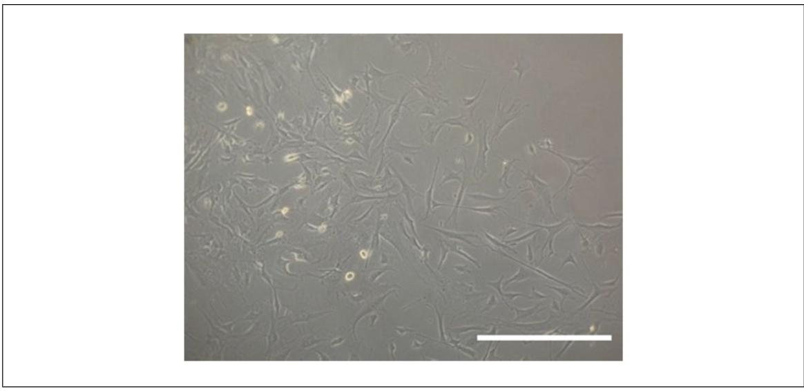 图2:原代骨细胞分离后的形态特征
