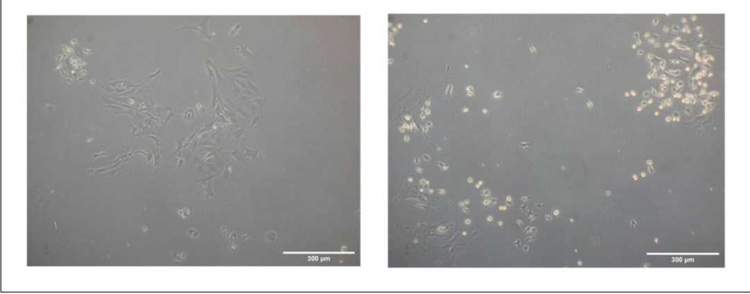 图3:Liberase TM 与胶原酶分离原代骨细胞的形态对比