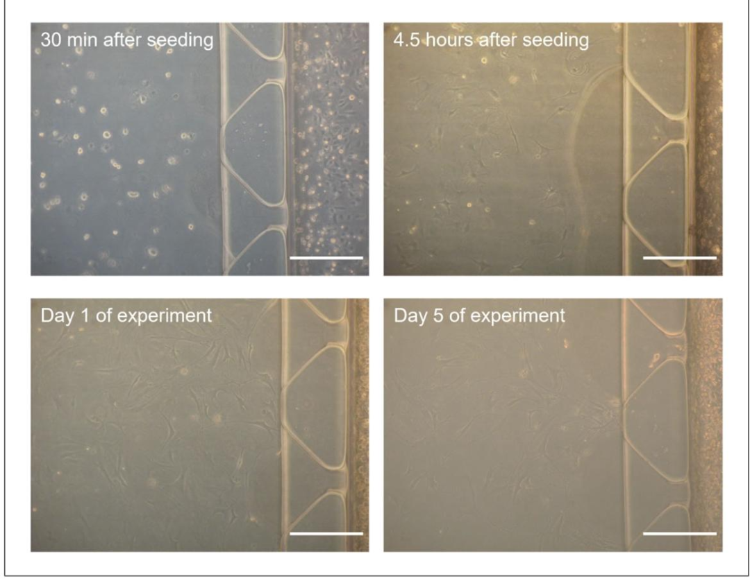 图7:微流控平台中原代骨细胞的培养时序与癌细胞外渗观察