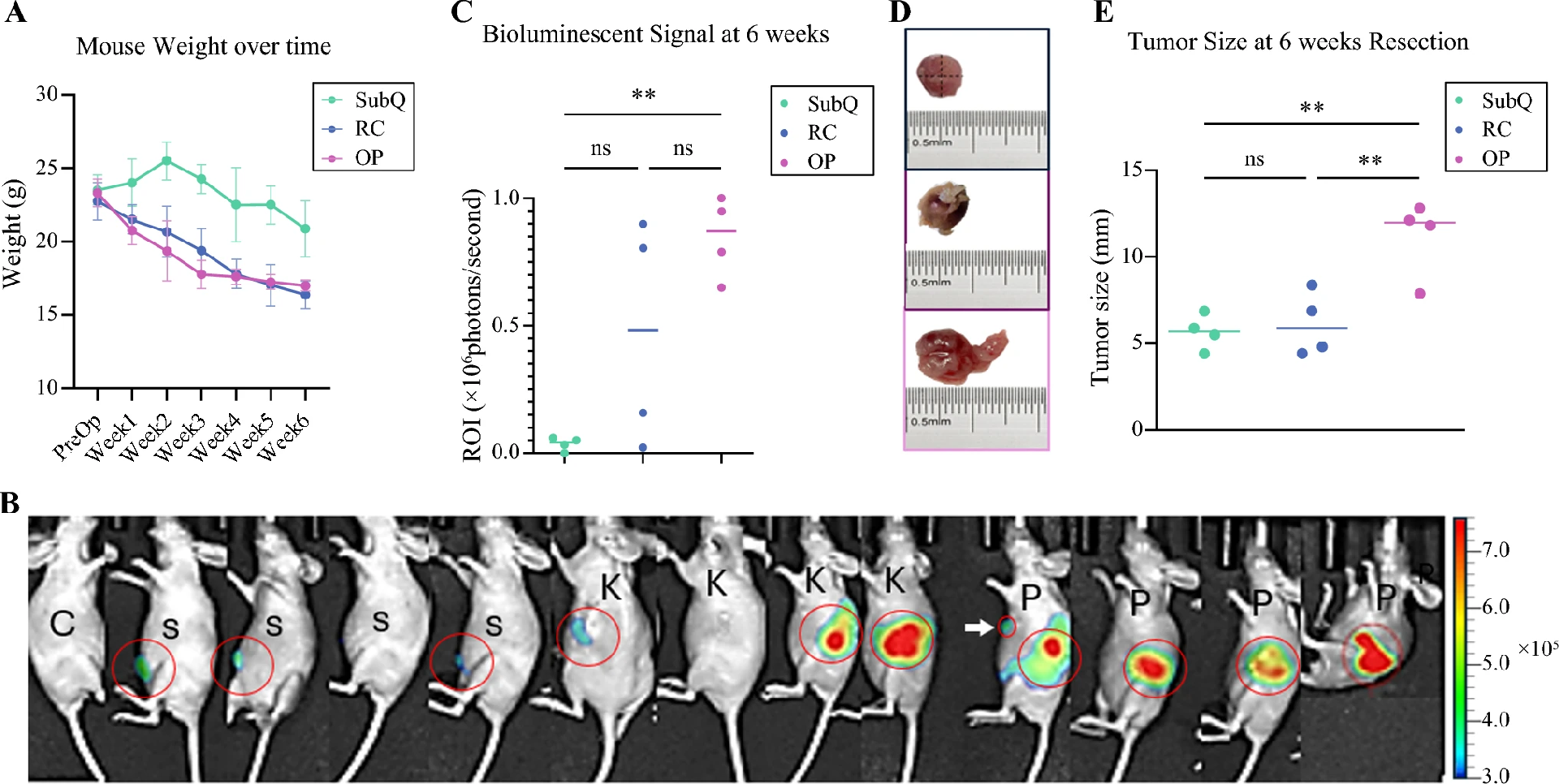 图2：三种移植模型的肿瘤生长和小鼠体重动态变化