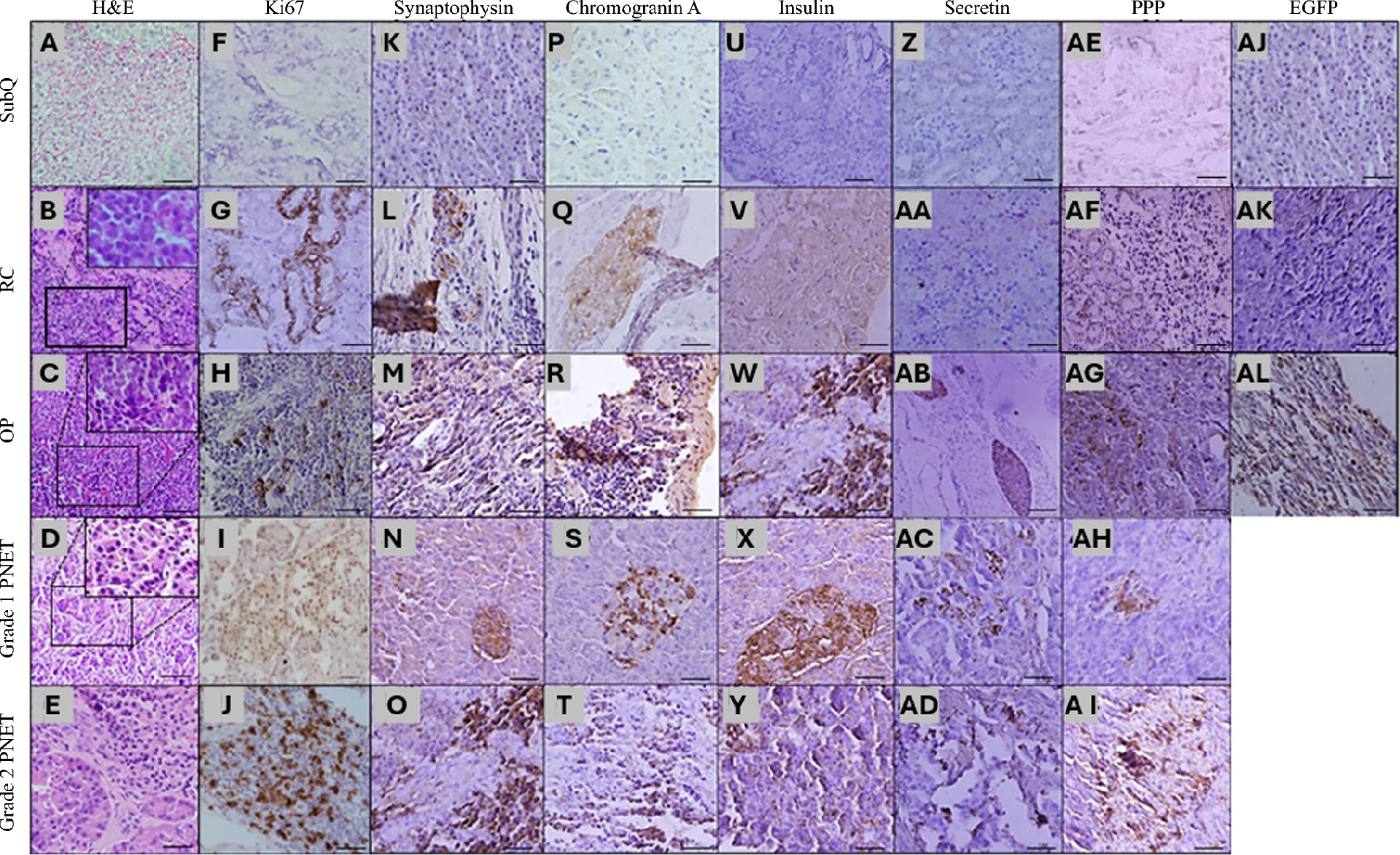 图3：三种移植模型的组织学和免疫组织化学分析