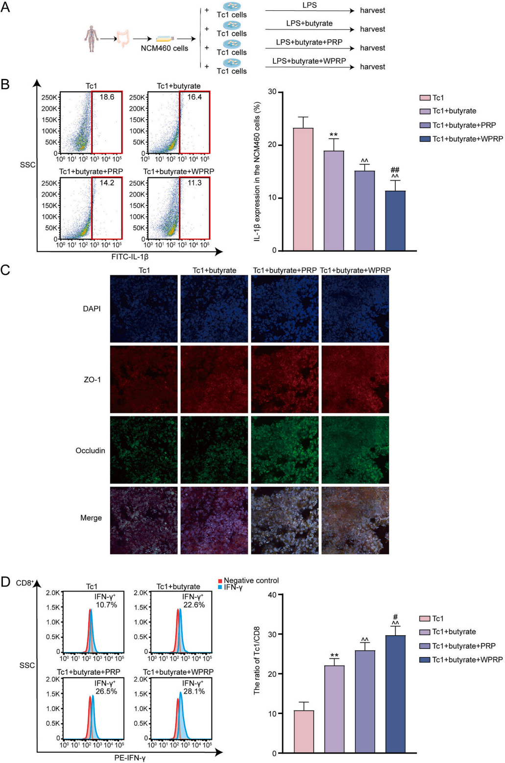 图11 | PRP和WPRP与丁酸协同，通过调节Tc1细胞增强肠道上皮保护作用