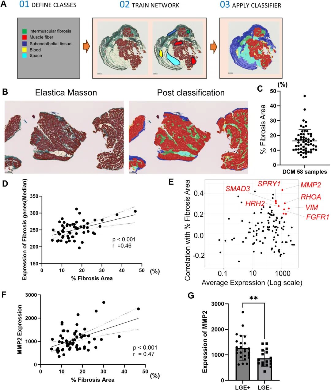 图 2:DCM 心肌纤维化的组织学 - 基因表达关联