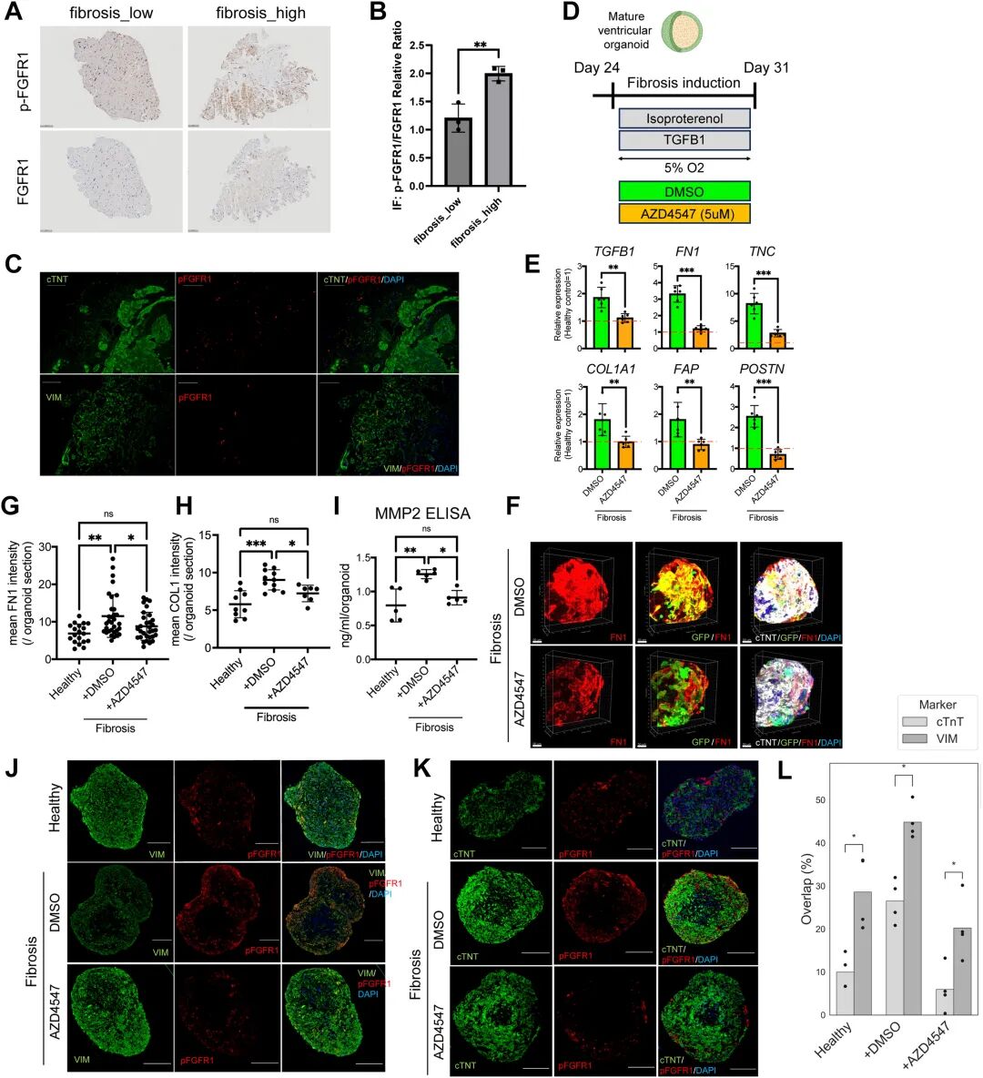 图 4:FGFR1 抑制剂在类器官中的抗纤维化机制