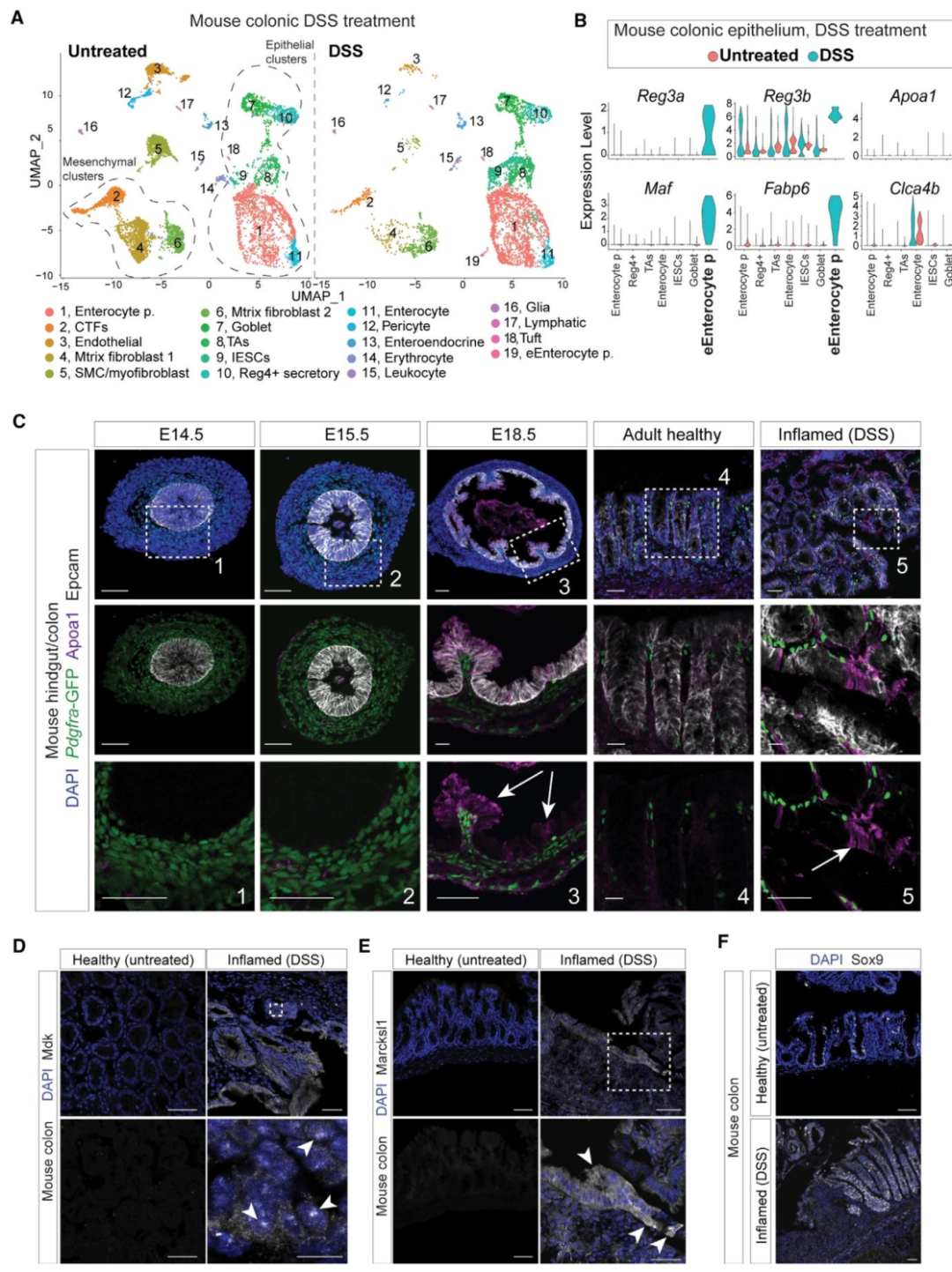 图 4:小鼠结肠炎上皮中胚胎程序的重激活