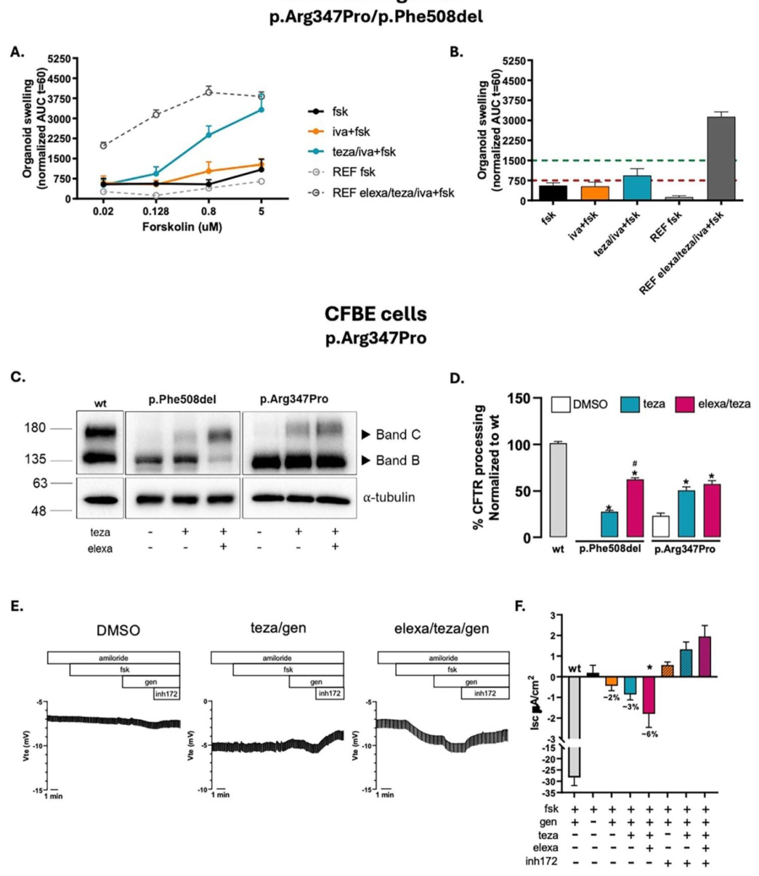 图 4：p.Arg347Pro 变异体的有限反应