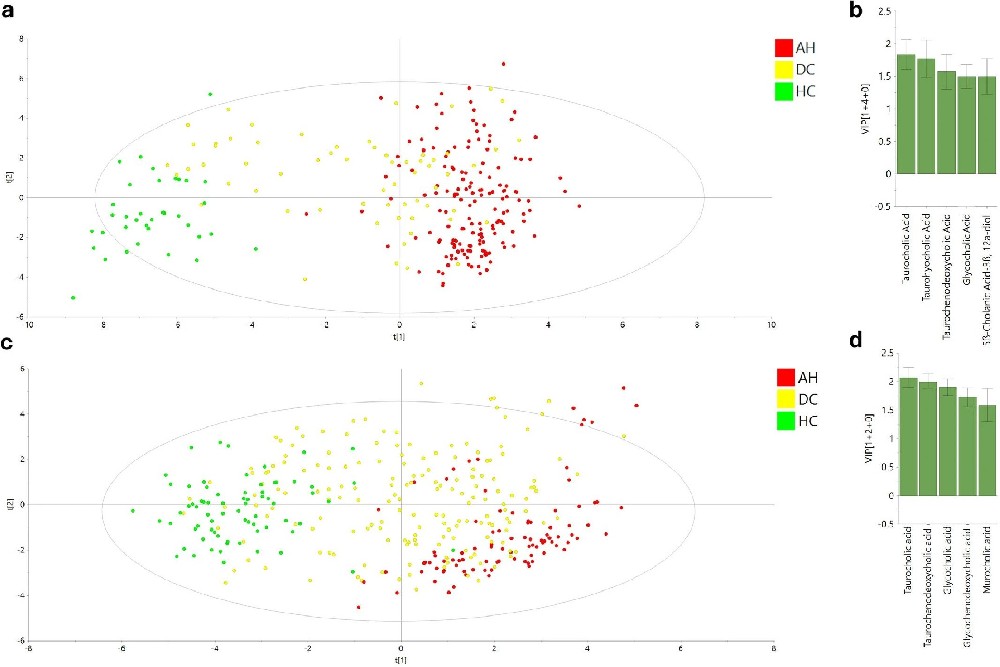 图1：胆汁酸谱可区分酒精相关性肝炎与失代偿性肝硬化及健康对照