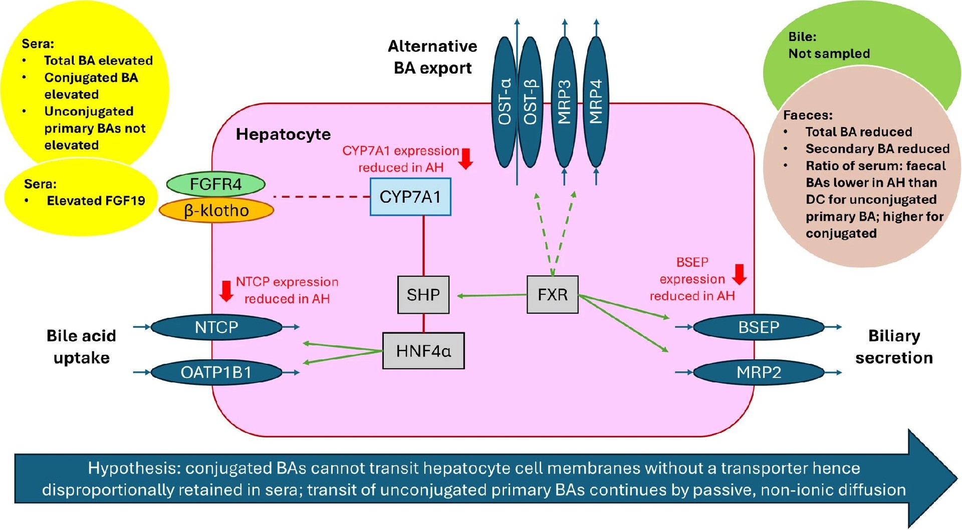 图7：AH 患者胆汁酸代谢紊乱的机制示意图