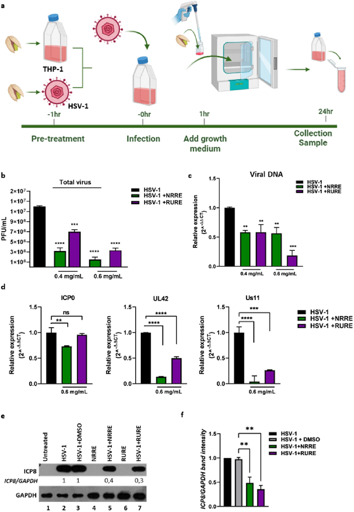 图1 NRRE/RURE 预处理显著抑制 THP-1 细胞中 HSV-1 复制