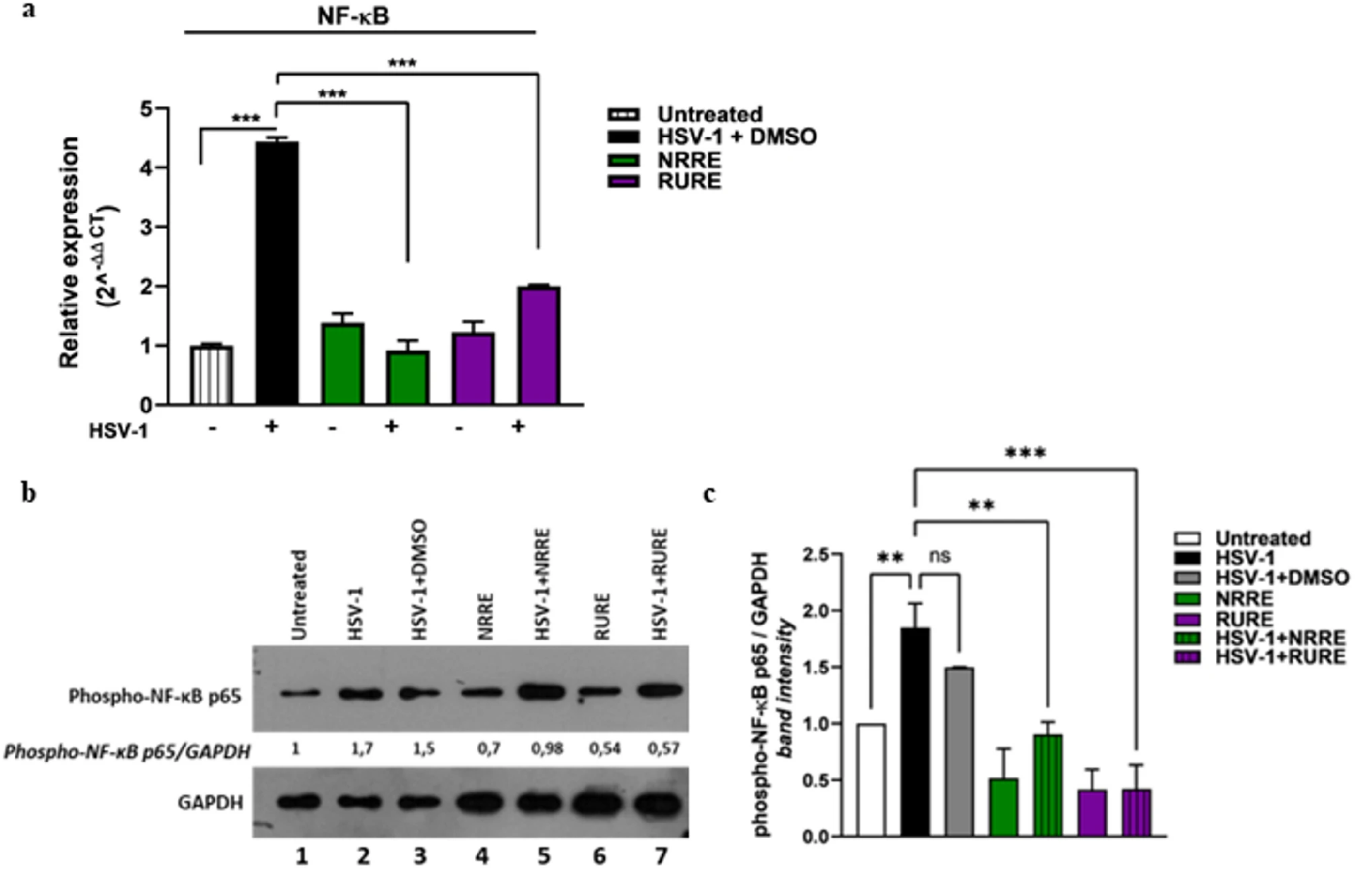 图4 NRRE/RURE 阻断 THP-1 细胞中 HSV-1 介导的 NF-κB 激活