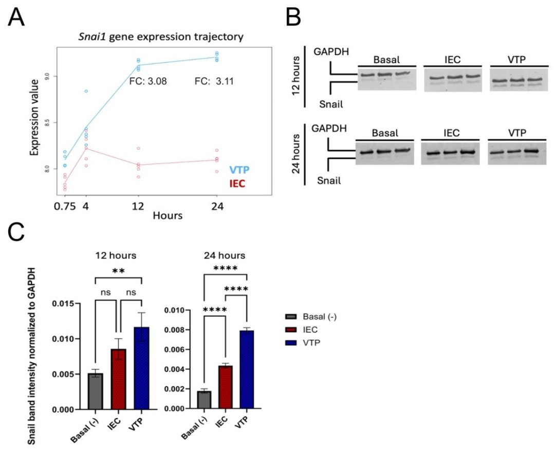图4：Snail 蛋白表达验证