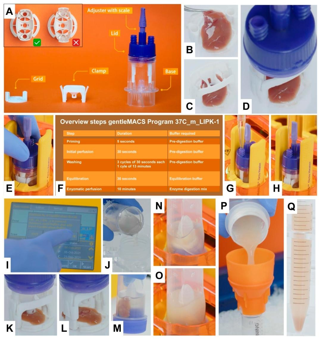 图2：肝细胞分离完整操作流程