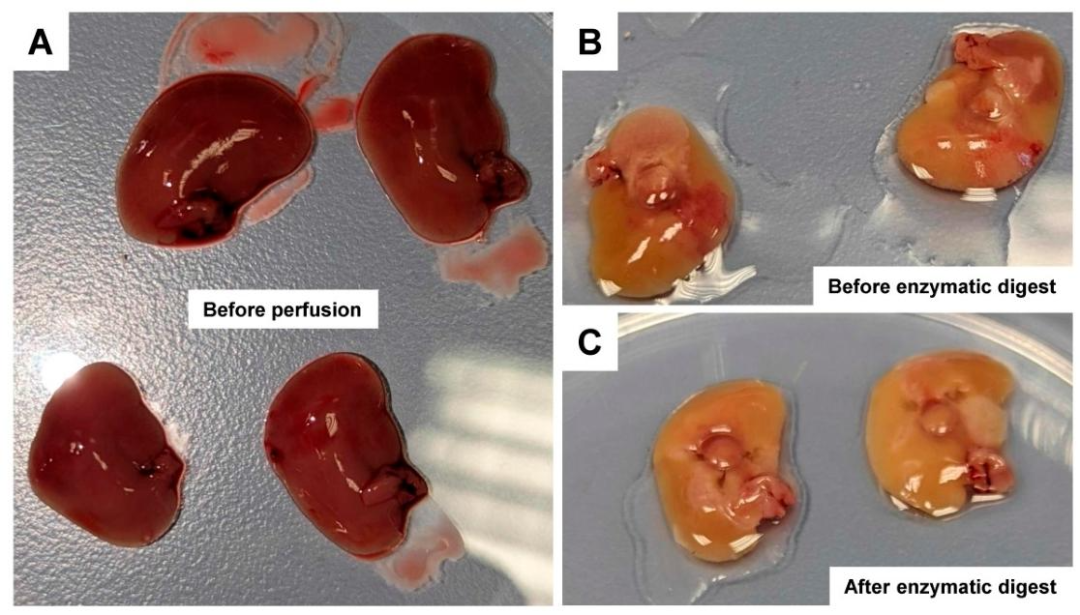 图3：肝组织灌注过程中的颜色变化