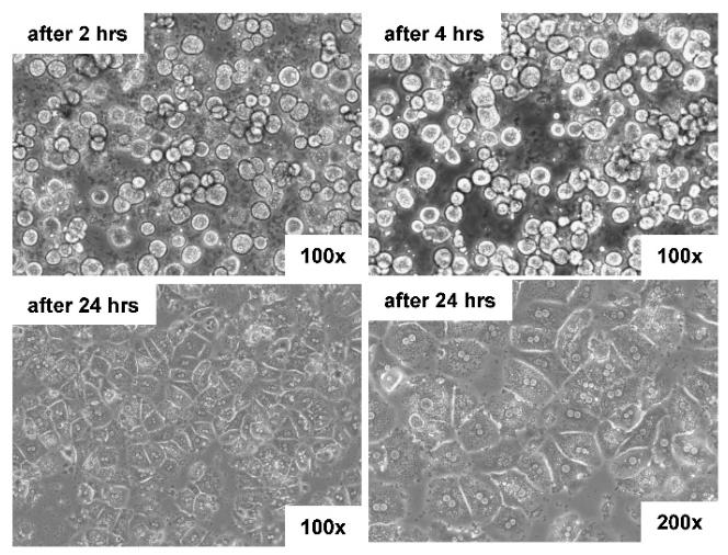图4：肝细胞形态学特征