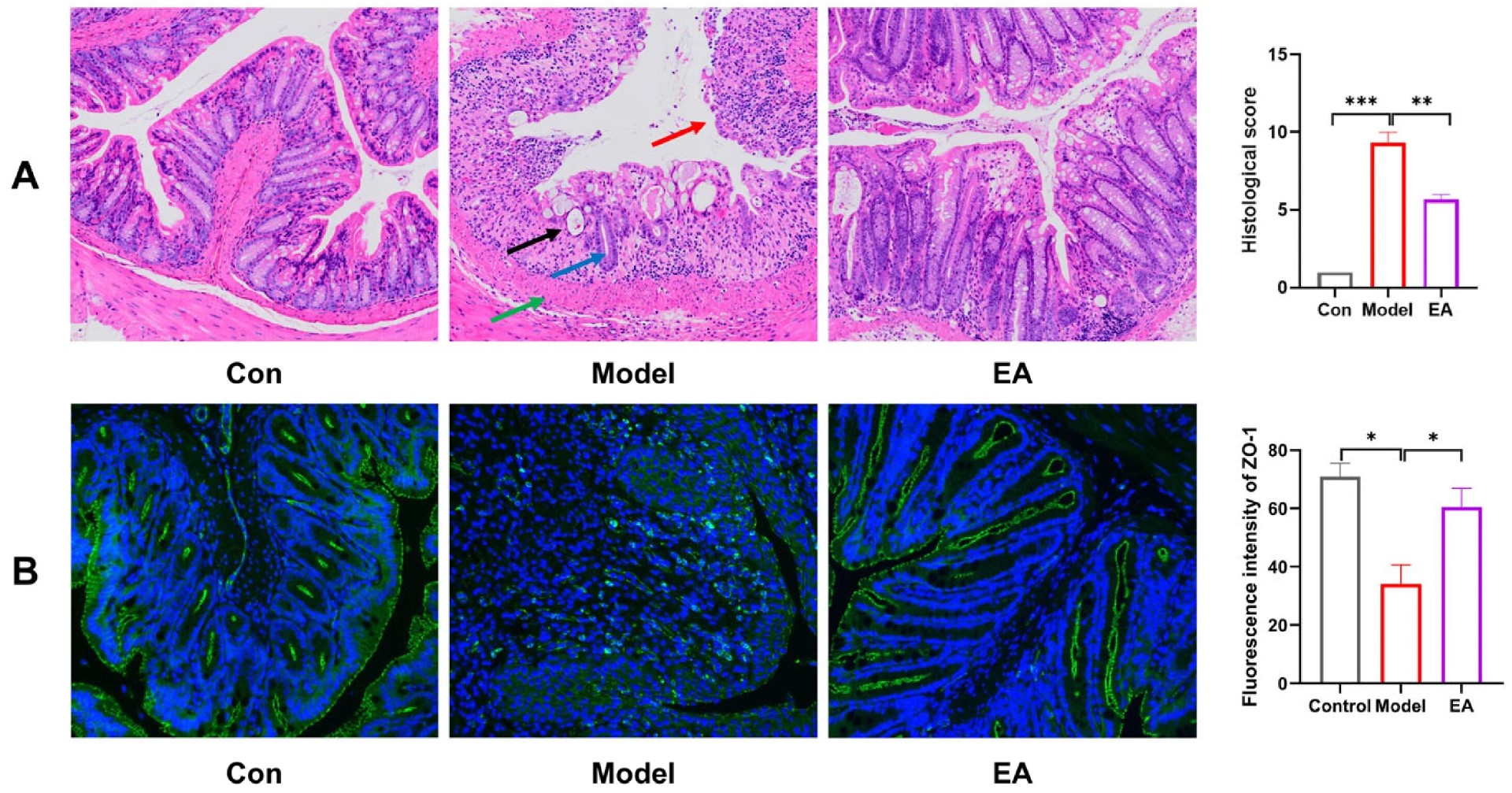 图6 EA 保护结肠组织结构与肠道屏障完整性