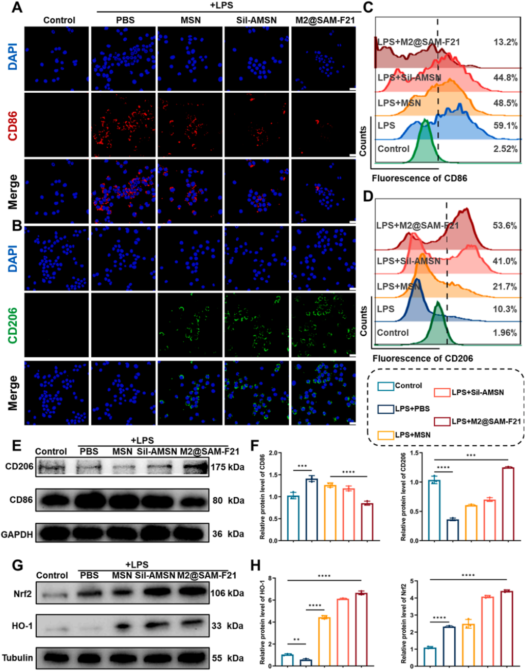 图3 | M2@SAM-F21的免疫平衡能力