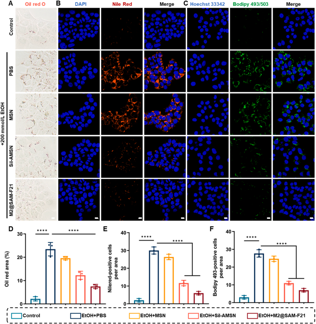 图4 | M2@SAM-F21的代谢调节能力。
