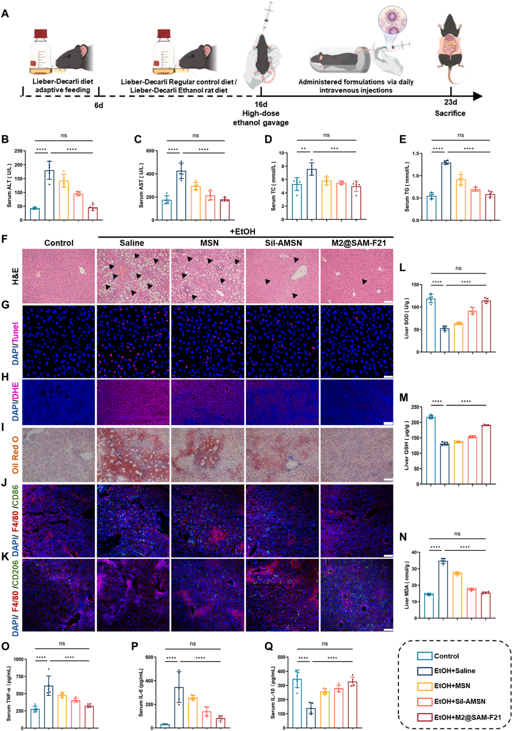 图6 | M2@SAM-F21对酒精性肝损伤(EtOH-ALI)的体内治疗效果
